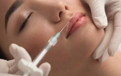 Injection acide hyaluronique : pour repulper ses lèvres