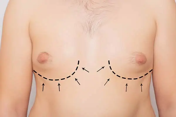 Seins : 3 façons de réduire le volume de la poitrine chez l’homme