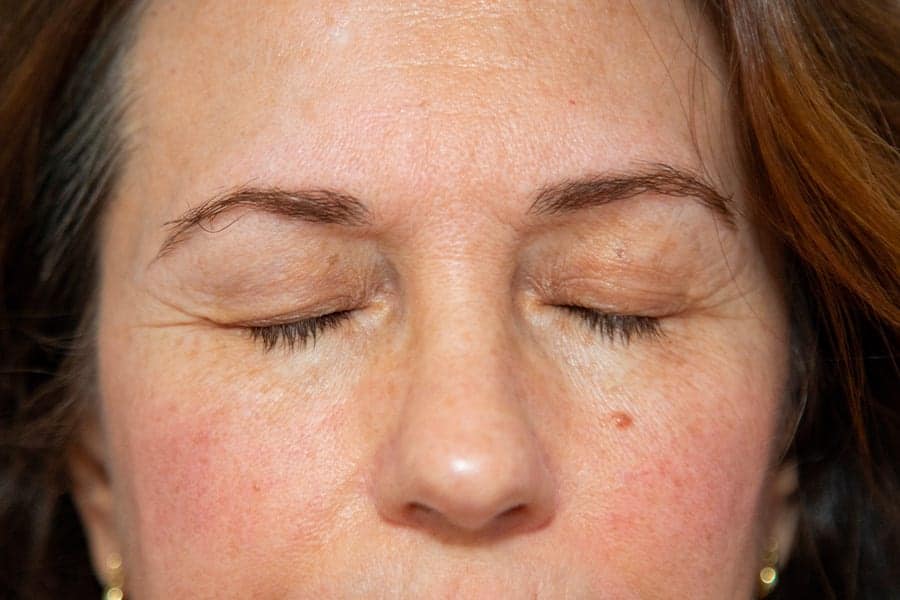 je regrette ma blepharoplastie rattraper blepharoplastie resultat decevant chirurgie esthetique visage docteur alexandre bouhanna chirurgien esthetique paris