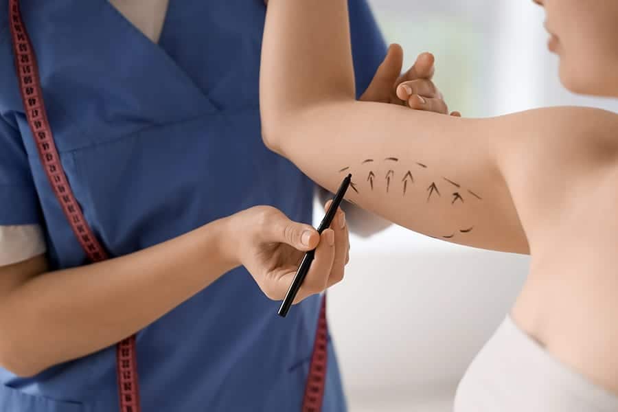 brachioplastie exercices pour raffermir les bras prix lifting bras docteur alexandre bouhanna chirurgien esthetique specialiste chirurgie mammaire paris