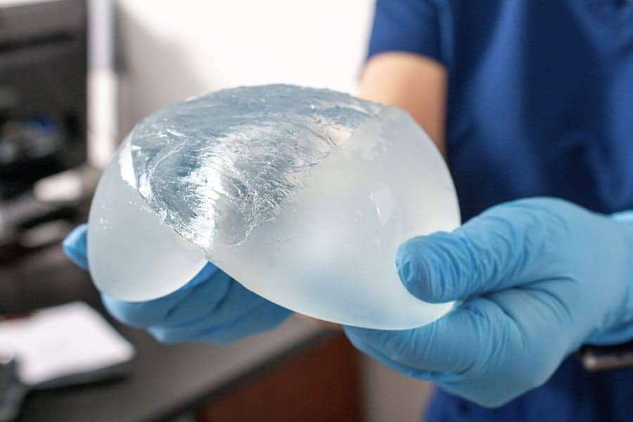 enlever protheses mammaires explantation ablation prix lifting mammaire apres retrait implants docteur alexandre bouhanna chirurgien esthetique specialiste chirurgie mammaire paris