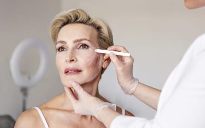 Œdème postopératoire après un lifting cervicofacial